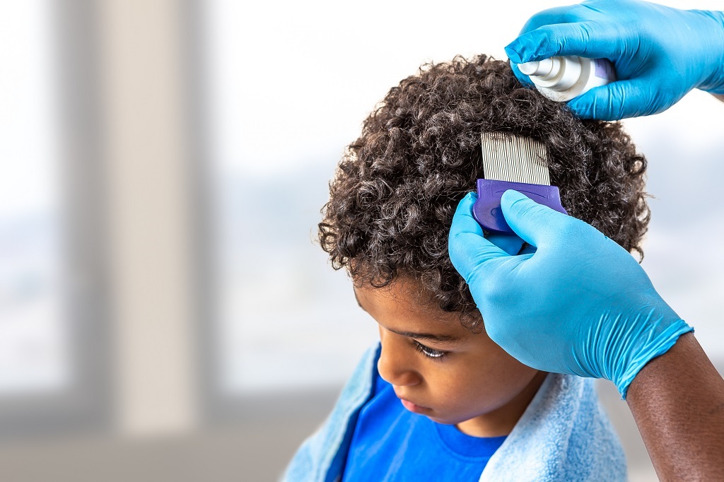 How Contagious is Head Lice? LiceDoctors